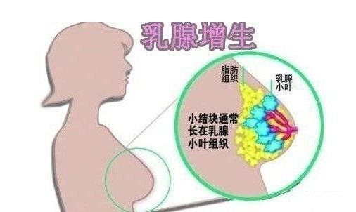 乳房出現(xiàn)“青筋”是什么原因呢？